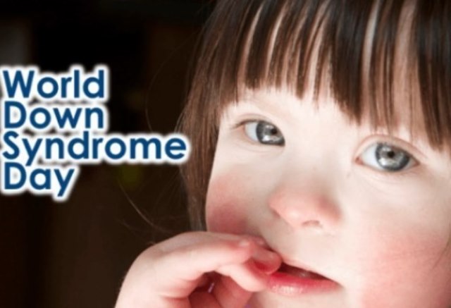 KC Sciacca Terme e KC Sciacca Monte Kronio celebrano la giornata mondiale della Sindrome di Down